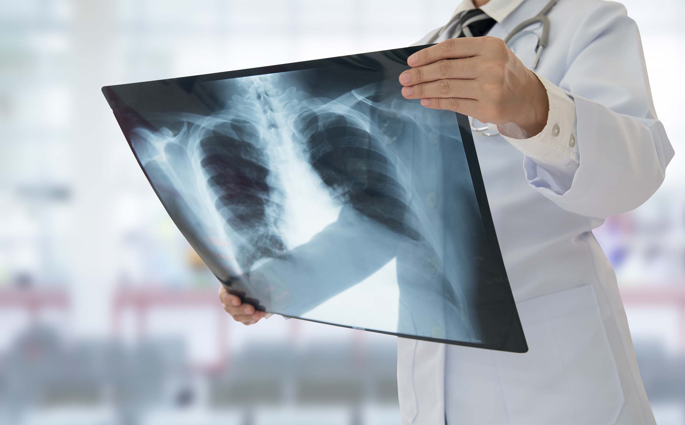 Shutterstock photo of Chest X-Ray.jpg